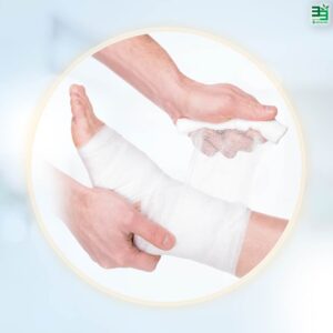 PACKAGE FOR TREATING CHRONIC DIABETIC WOUNDS 7 TIMES