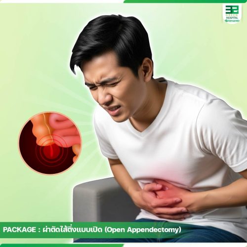 2.ปกแพ็กเกจผ่าตัดไส้ติ่งแบบเปิด-Open-Appendectomy-ธ.ค.68-01