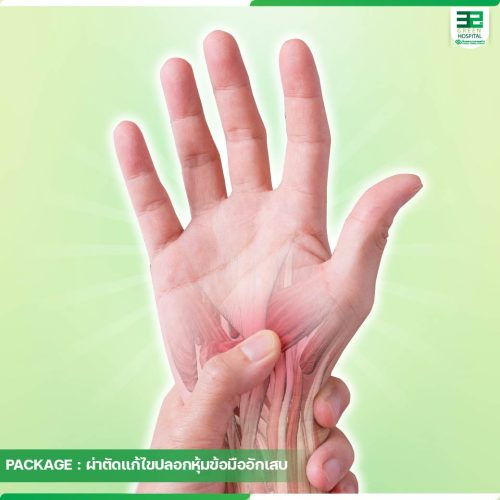 4.ปกแพ็กเกจแก้ไขปลอกหุ้มข้อมืออักเสบ-ธ.ค.-68-01