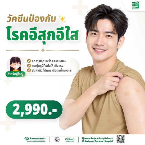 (New) ปกวัคซีนป้องกันโรคอีสุกอีใส (สำหรับผู้ใหญ่)-01